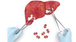 World Hepatitis Day: Why it’s important to take care of your liver health?